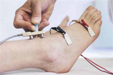 lumbar foot drop but normal nerve conduction test|painful nerve conduction study.